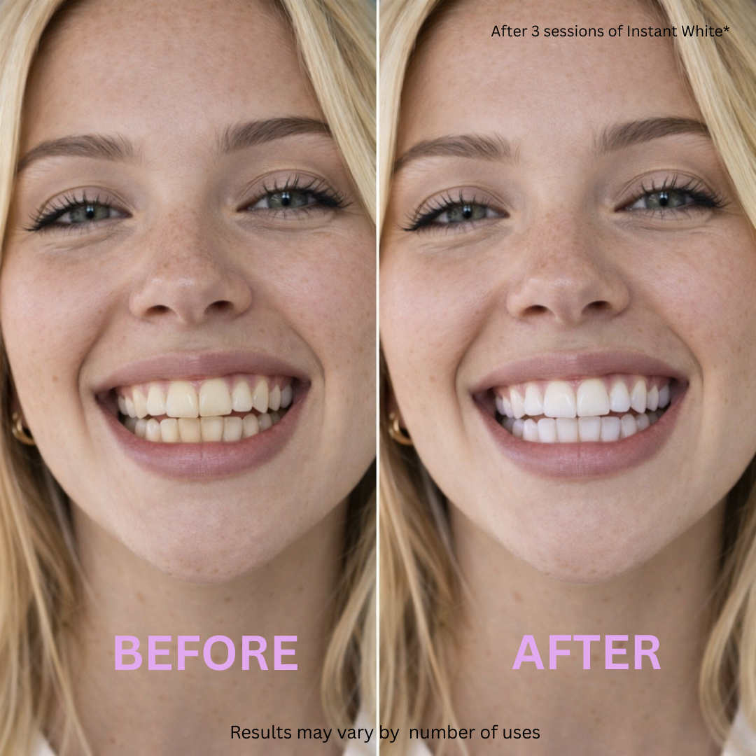 Instant White™ – V34 Color Correcting Whitening Strips