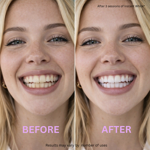 Instant White™ – V34 Color Correcting Whitening Strips